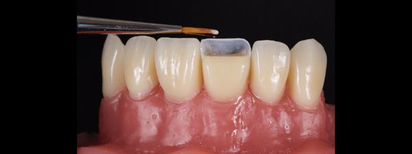 Composite Bonding